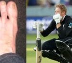 5 cricketers ne partial disability ko kamzori na banne diya