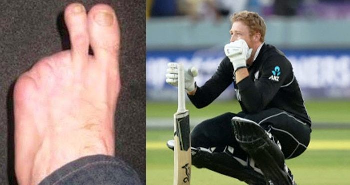 5 cricketers ne partial disability ko kamzori na banne diya